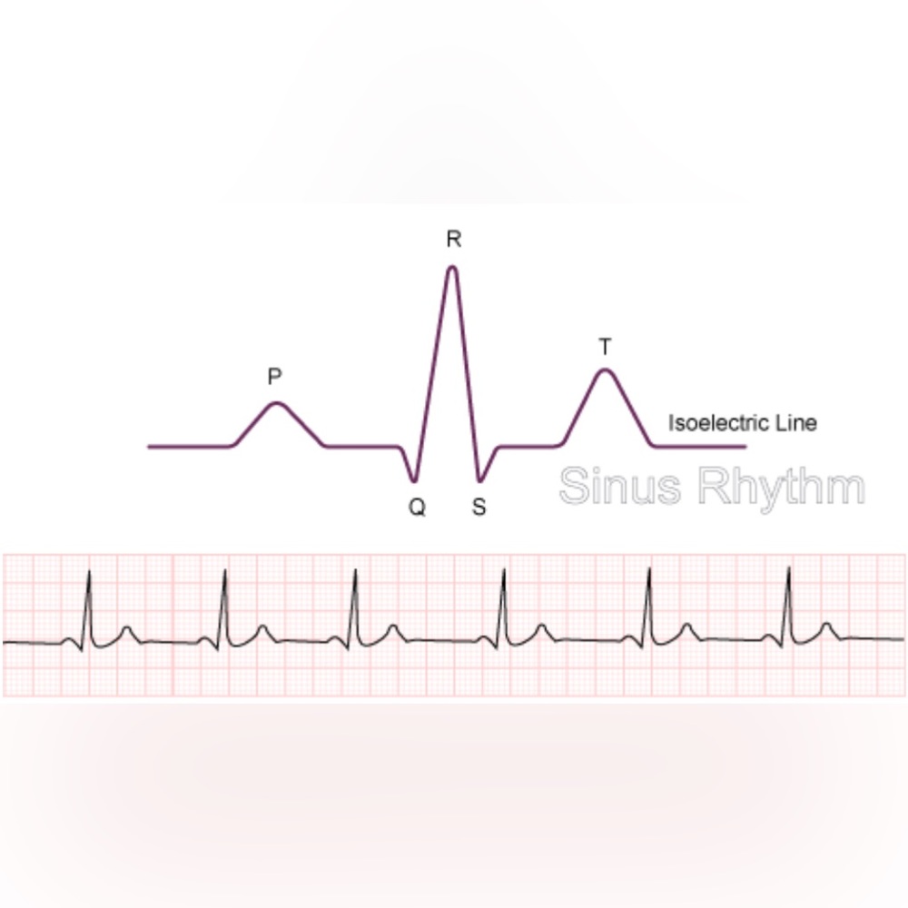 EKG ECG Electrocardio Heartbeat Heart Sinus Rhythm Med Doctor Nurse Silver Studs - Picture 4 of 11